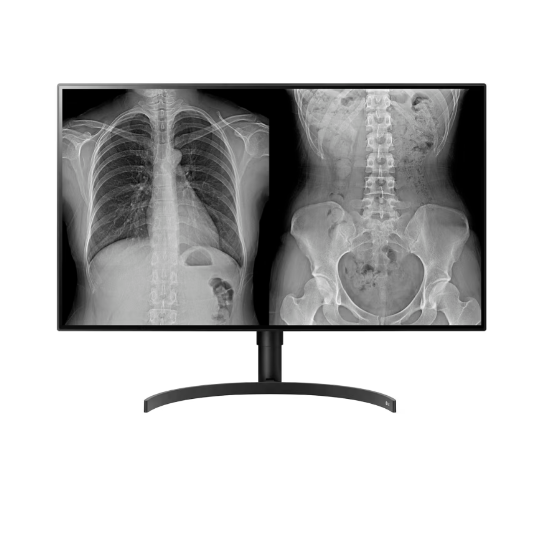 LG 32” 8MP Diagnostic Color Monitor with Nano IPS™ LCD, ideal for Radiology Workﬂow - Native resolution 3840 x 2160.