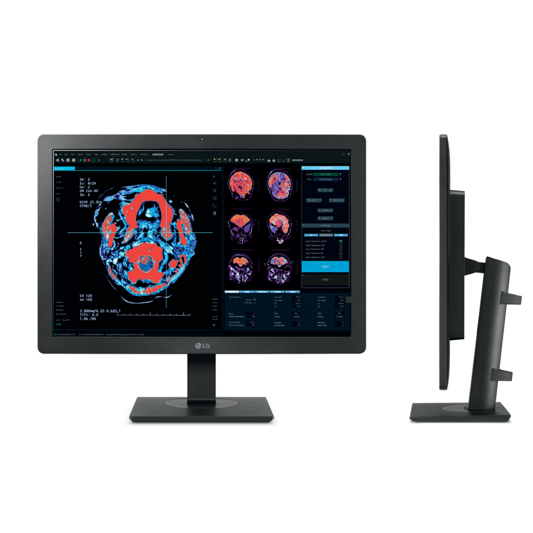 Transform your diagnostic radiology workflow with the LG 24HR513C-B IPS Diagnostic Monitor.