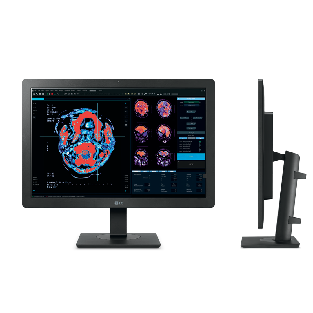 LG 24” 2MP IPS Diagnostic Monitor - MDM