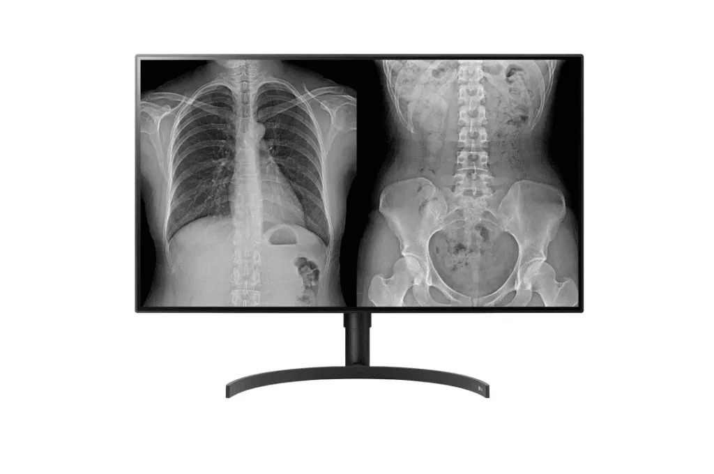 LG 8MP (3840x2160) Nano IPS Color Diagnostic Monitor with Multi Resolution and Clinical Pathology Modes, Auto Luminance Calibration, PBP/Dual Controller & Ergonomic Stand