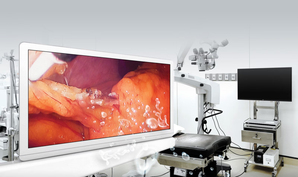 The detailed picture quality of the LG surgical monitor meets operating room requirements. With its 27-inch Full HD IPS Display, the LG surgical monitor improves work efficiency.