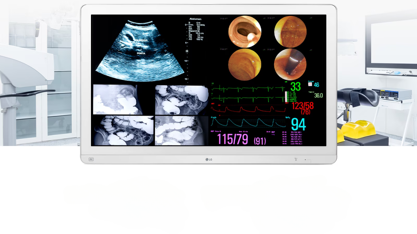 the LG 32HL714S 31.5-inch 4K UHD IPS Surgical Monitor, engineered for exceptional surgical visualization.