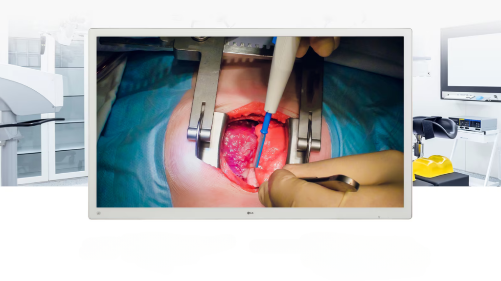 This LG surgical monitor includes HDR10, ensuring clear display of HDR images crucial for accurate medical visualization. 