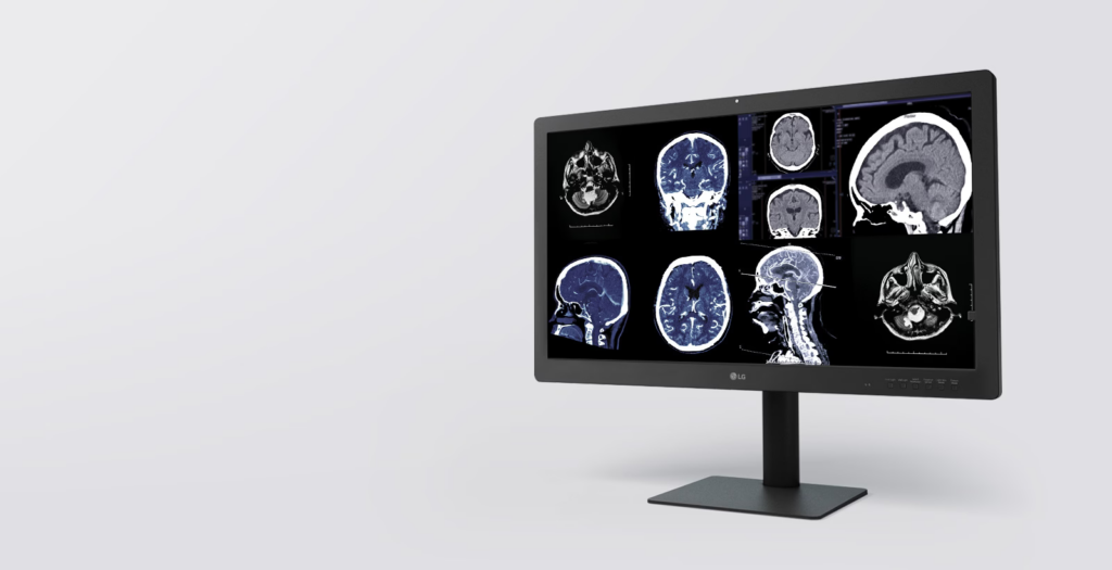 Discover the LG 32” 8MP IPS Black Diagnostic Monitor, a cutting-edge diagnostic monitoring & development tool designed to revolutionize radiological imaging. As a leading lg 8mp diagnostic monitor, the LG 32HQ713D sets new standards in diagnostic accuracy and efficiency. 