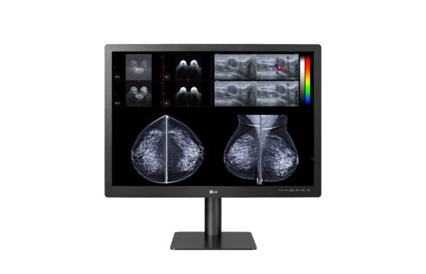An image of the LG 31" 12MP Diagnostic Monitor, a high-resolution medical display designed for precise medical imaging and diagnostics."