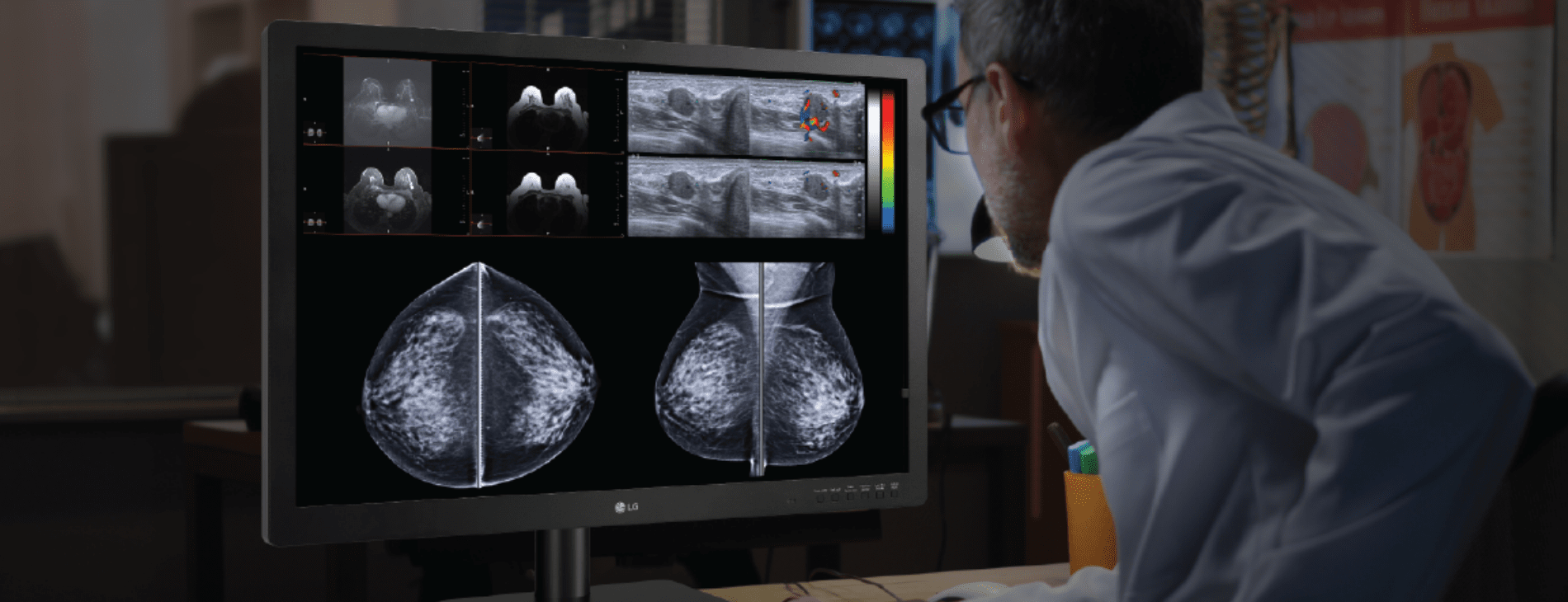 Radiologist analyzing diagnostic scans on LG medical monitor for accurate diagnosis.