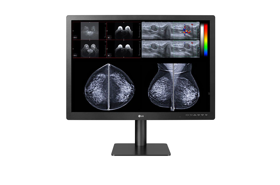 Transform your radiology practice with the LG 31HN713D-B Diagnostic Monitor, offering FDA-approved accuracy and versatility.